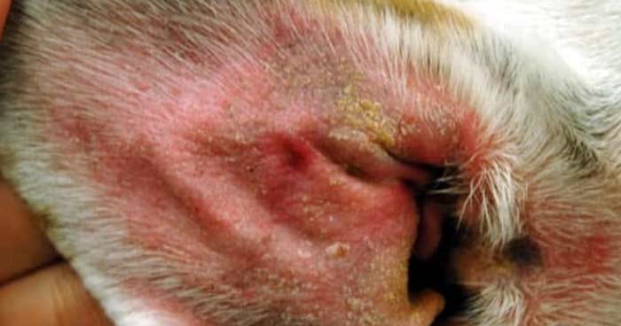 Yeast Infections